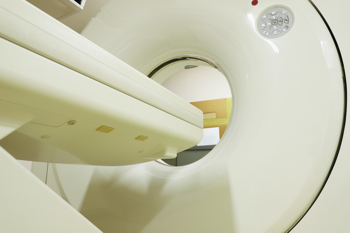 МРТ ангиография интракраниальных сосудов (артерии и вены) - 2