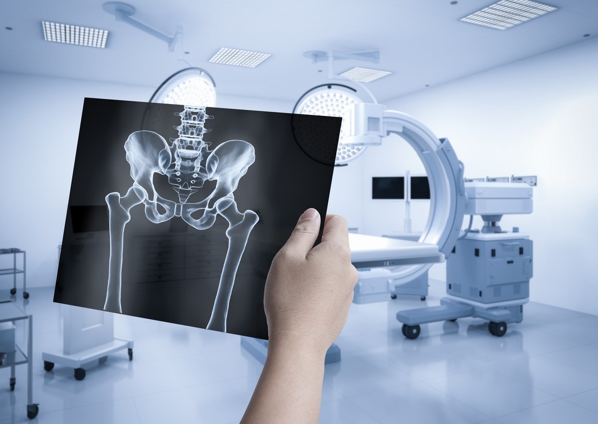 МРТ костей таза - 7